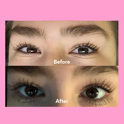 Professional lash lift procedure at Laser Skin Solutions in Portland, OR, showing the precise application of keratin-infused lifting solution.